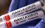 Hantavirüs’de son durum: Birçok ülke vatanda... Hantavirüs’de son durum: Birçok ülke vatanda...